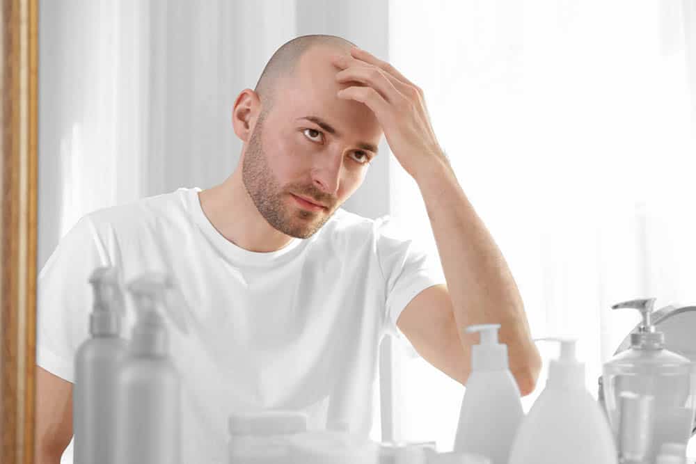 Hereditary Baldness: The Genetics of Hair Loss